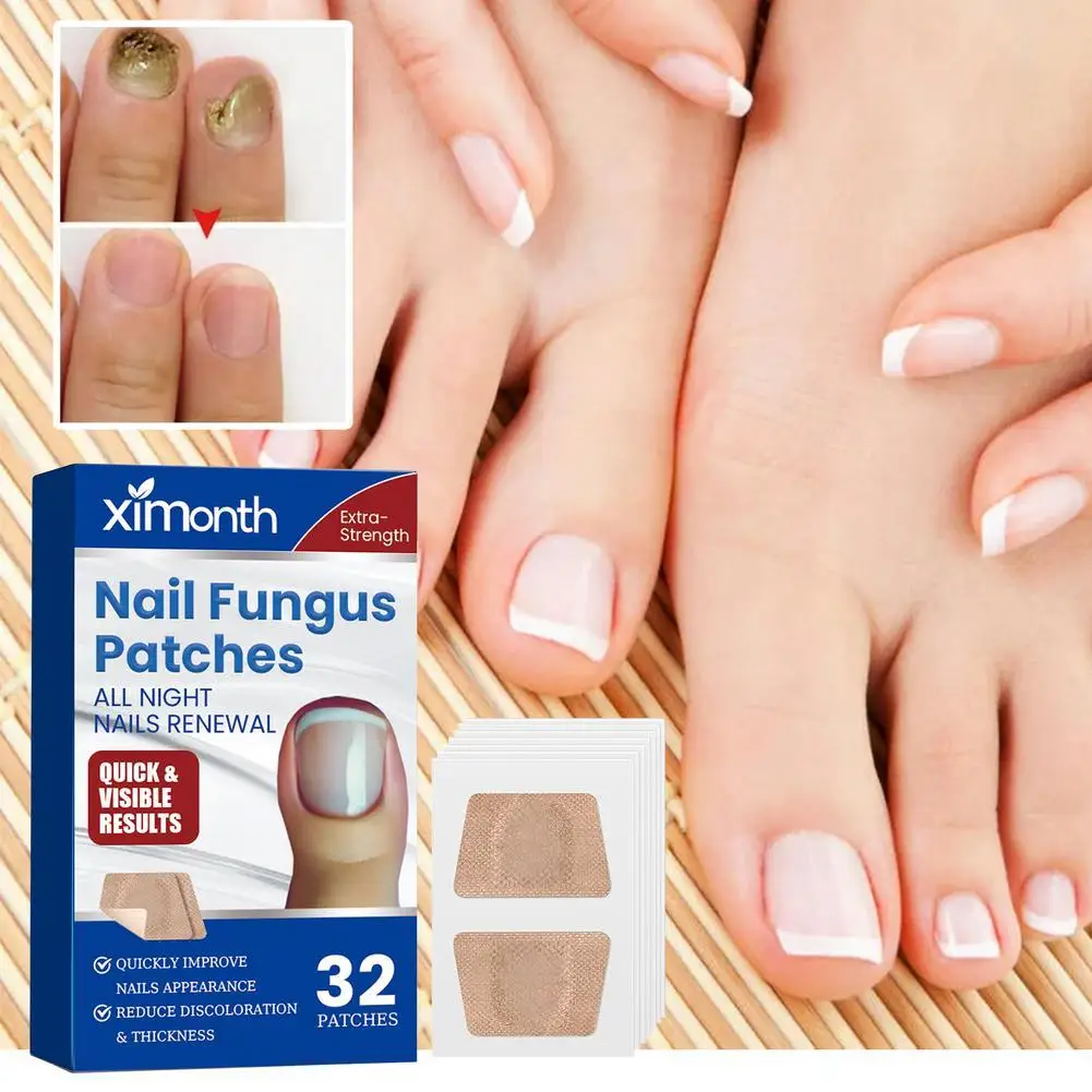 

Nail Repair Patches Toenail Fungus Patch Sticky Toenail Care Nail Ingrown Correction Sticker Paronychia Nail Treatment 32 Patch