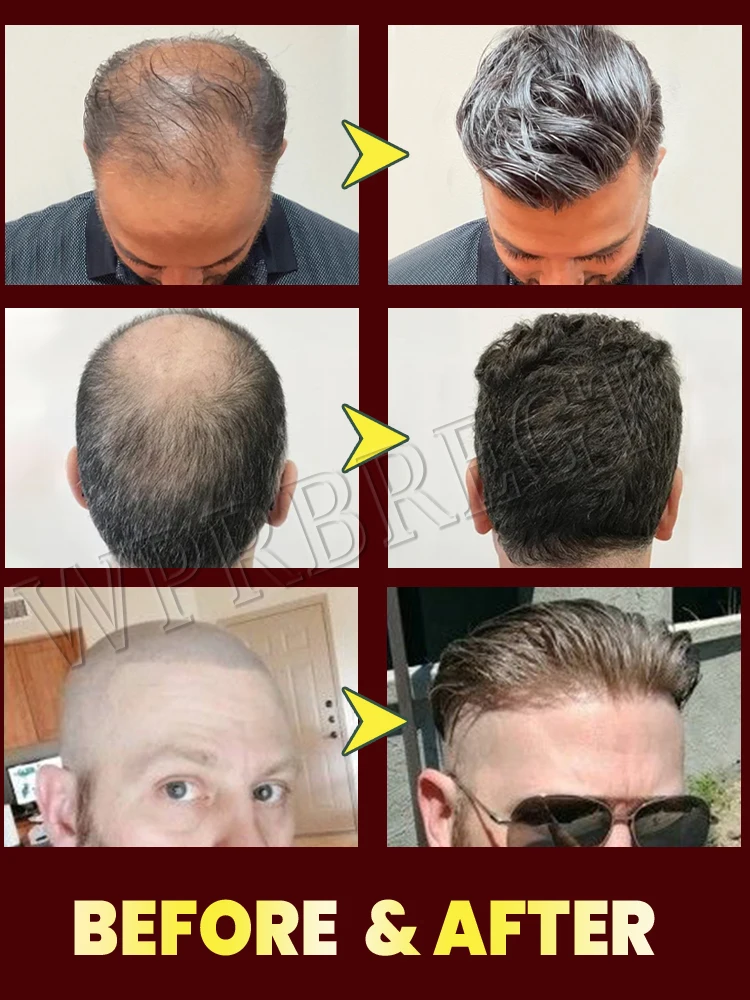 ̊خلبيش ذاكرة نمو، لحية الوجه، ذاثرى أوب سينوب من ذاقيد، تشيشت، أرمش، جميع شعر البابين، جميع شيميازابل #2