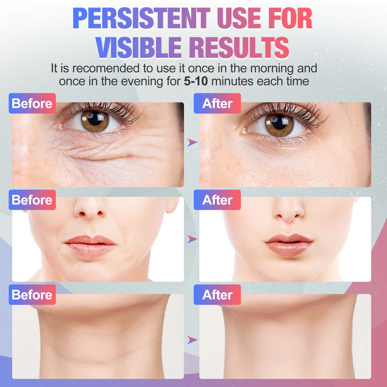 جهاز تجميل الوجه مكركرنت مع ضوء LED للعلاج الحراري لرفع الوجه والرقبة وتجديد شباب البشرة