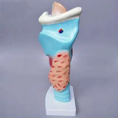 

Anatomical model of larynx larynx laryngeal structure enlargement mold throat otorhinolaryngology medical teaching stereo