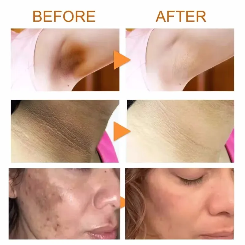 Corpo Branqueamento Sabonete Pele Profunda Branqueamento, Iluminar Esfoliação Corporal, De Oelhos Partes Íntimas, Axilas, Branco Nutritivo Cuidados