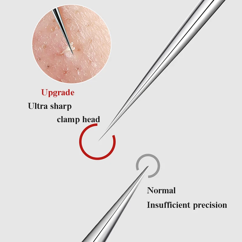 4/5 Stück Mitesser entferner Komedonen Extraktor Akne-Entfernungs-Kit für Makel Whitehead Popping Zit Entfernen für Nase Gesicht Werkzeuge