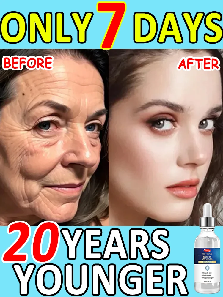 

2025,Upgraded new model, no wrinkles.Wrinkles disappear Become beautiful now