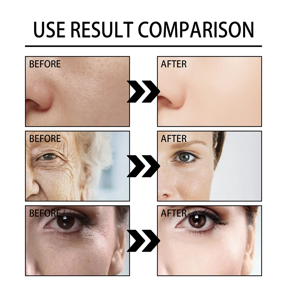 Snail Serum Cream Anti Wrinkle Cream Face Moisturizer Face Lifting Cream Anti-aging Essence Face Whitening Cream Skin Care Tool