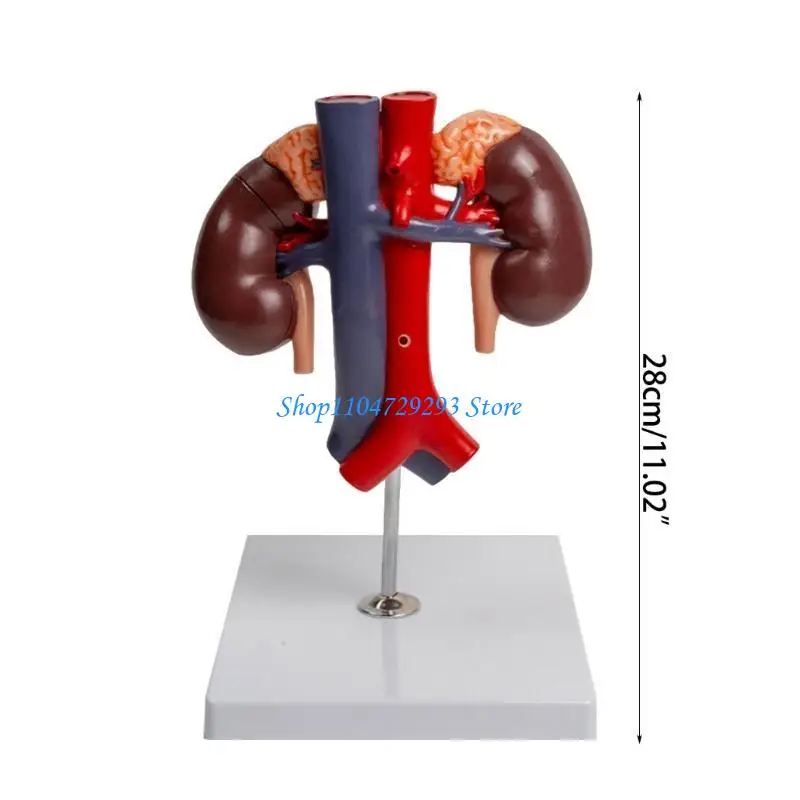 O modelo anatômico do Y2GD inclui aorta abdominal, pâncreas, baço e duodeno