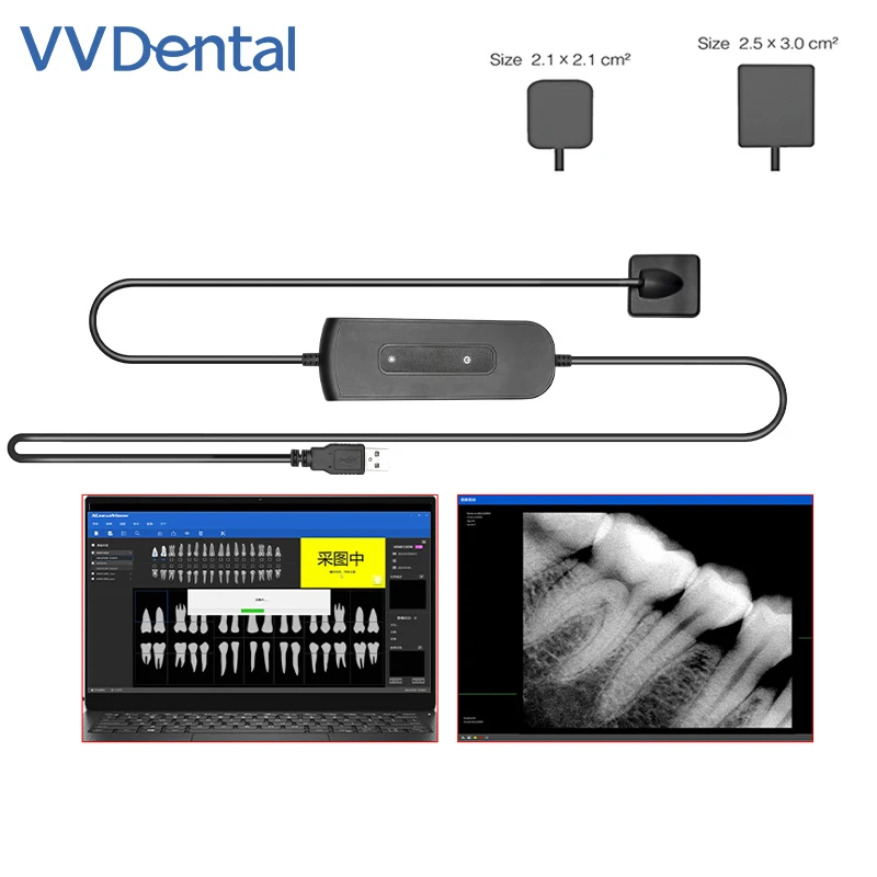 VVDental Dental Sensor X-Ray Radiovisiograph Digital Sensor Intraoral Imaging System HD Image RVG Sensor