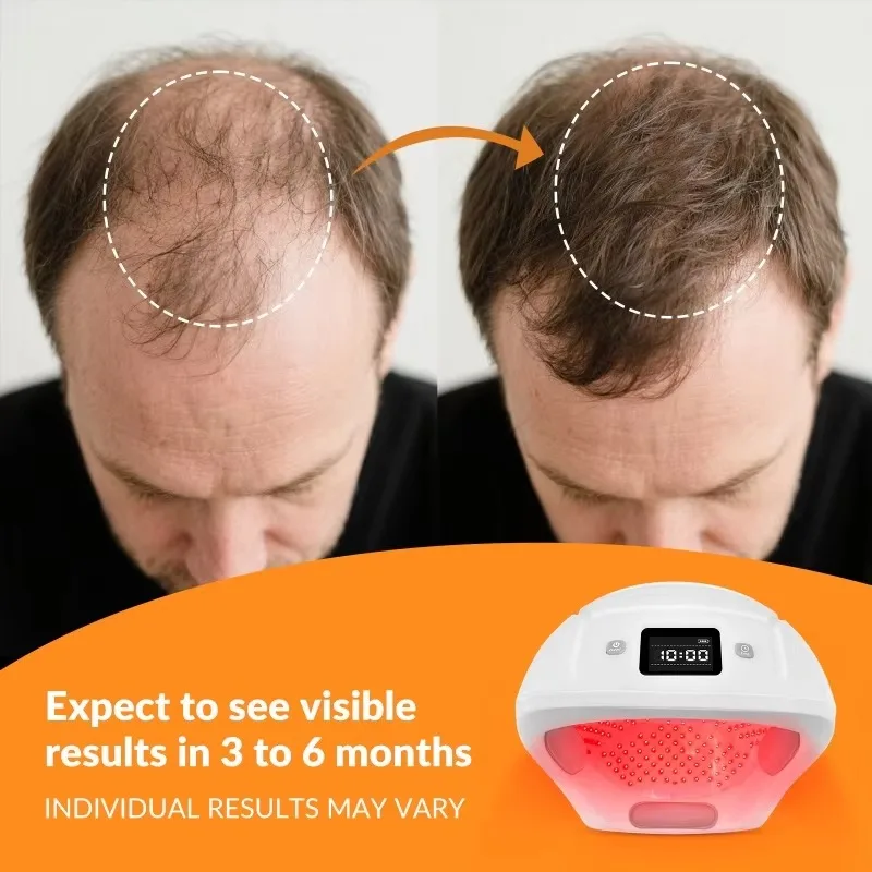 GOVW Hair Growth Helmet Laser Hair Therapy Cap Red Light Therapy Helmet 650nm 448 Diodes Portable for Damaged Alopecia Areata