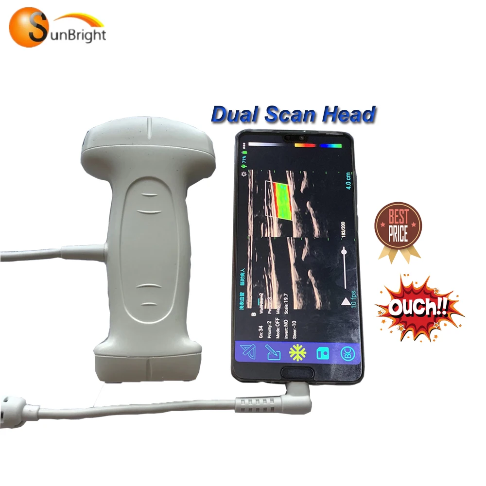 SUN-D3 portable USB dual linear and convex probe ecografo portatil color doppler ultrasound