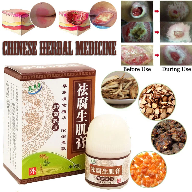 1PC Herbal Removal Rot Myogenic Cream Bedsores Paste Treat Pressure Sores/Decubituses/Pressure Ulcer Festering Wound Healing