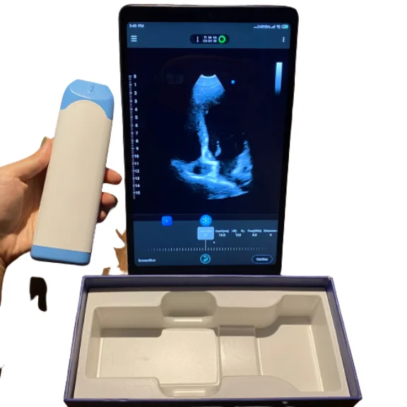 Portable Electric Color Doppler Pad Phone Ultrasonic Scanner Mini Wireless Transducer Phase Sector Array Probe Plastic Metal