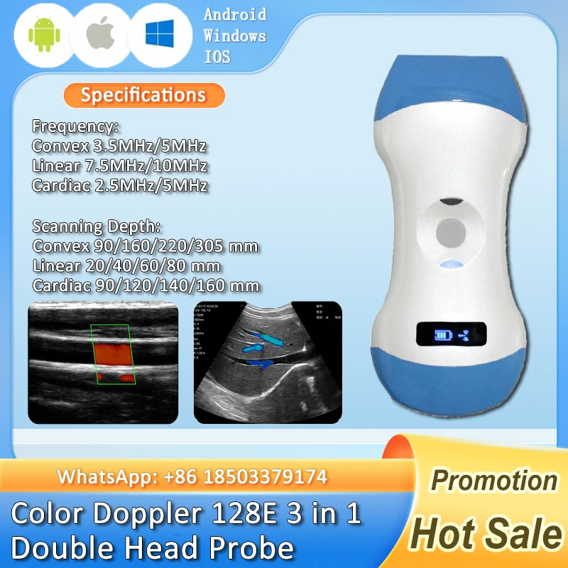 Wireless Portable Ultrasound Probe scanner WIFI Doppler wifi ultrasound scanner Machine support iOS Android Windows