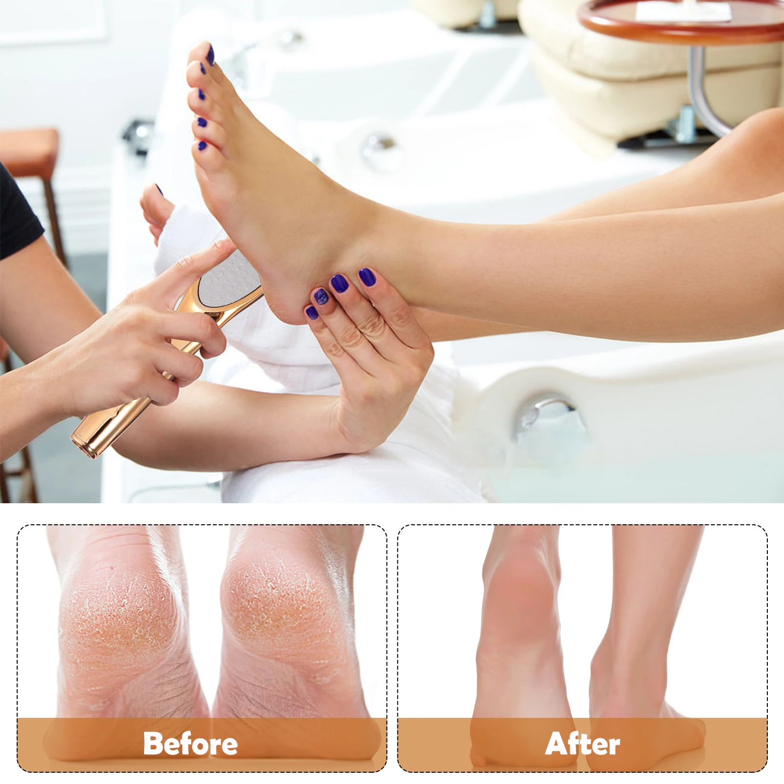 

Glass File Rub Tool Nano Scrubber Hard Skin Dead Pedicure Polisher Foot Care Files Long Handle Callus Remover Foot File for Gift
