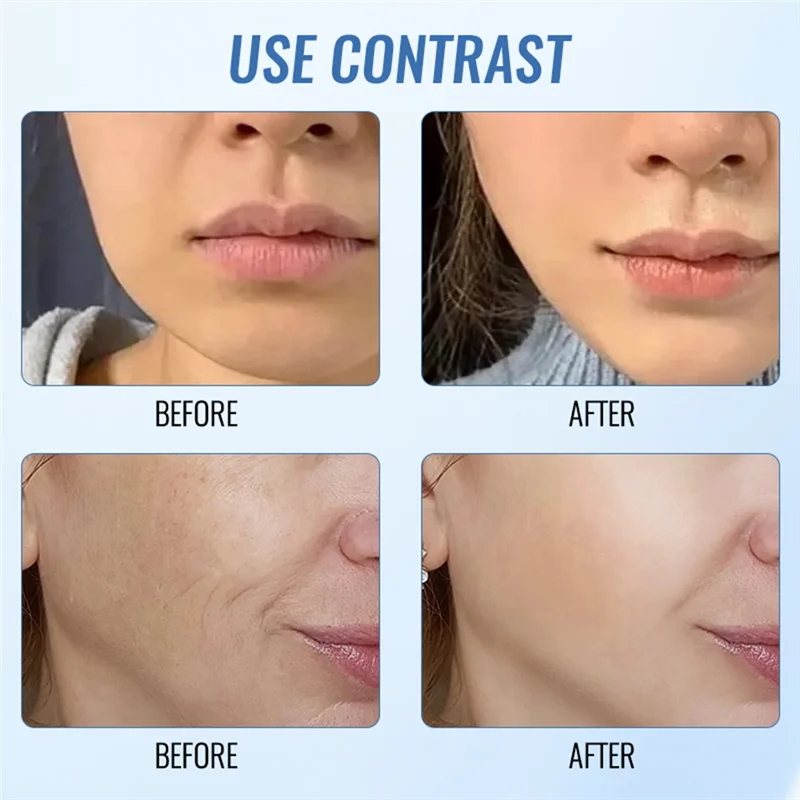 【STOKED】LED Facial Beauty Care Device 7 In 1 EMS Microcurrent Skin Rejuvenation Face Lifting Facial Neck Firming Massage