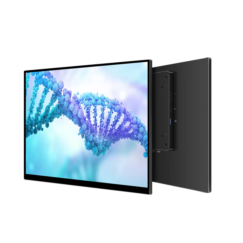 Monitor portátil de grado médico, pantalla táctil de 15,6 pulgadas, 4k OLED, 1ms, 100% DCI-P3, para equipo médico hospitalario, montaje VESA