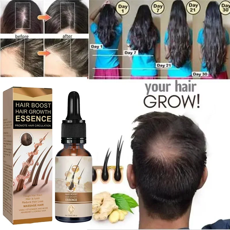 Biotin Fast Hair Growth Oil Hair Regrowth Serum aHair Thinning Treatment aHair Growth Liquid Anti-Hair Loss for Women and Men