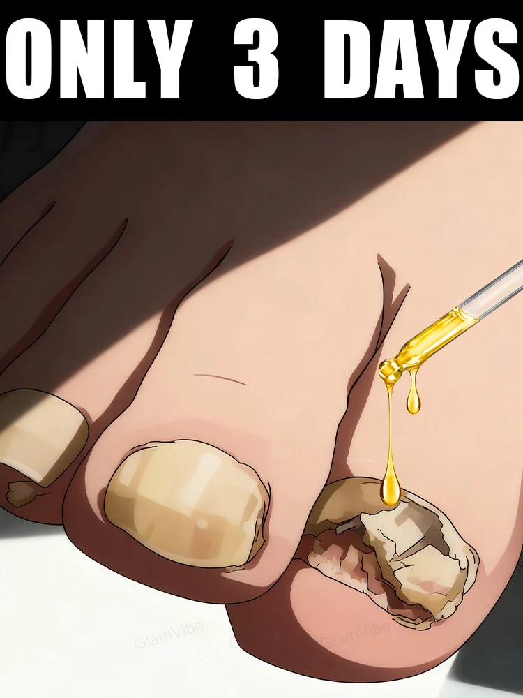 

ᑫᵘⁱᶜᵏ ᵀʳᵉᵃᵗᵐᵉⁿᵗ⸴ ᔆᵃʸ ᴳᵒᵒᵈᵇʸᵉ ᵗᵒ ᶠᵘⁿᵍᵃˡ ᴺᵃⁱˡ ᵂᵒʳʳⁱᵉˢHot-selling nail cleaning brush