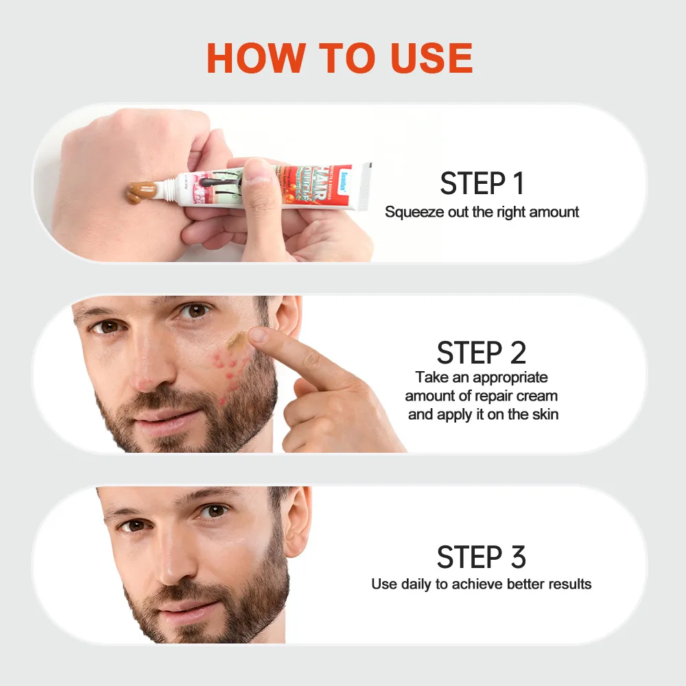 Body Acne Removal Cream Treatment Face Butt Back Acne Marks Smooth Repair Chicken Skin Cream Moisturizing Whitening Skin Care - view 6