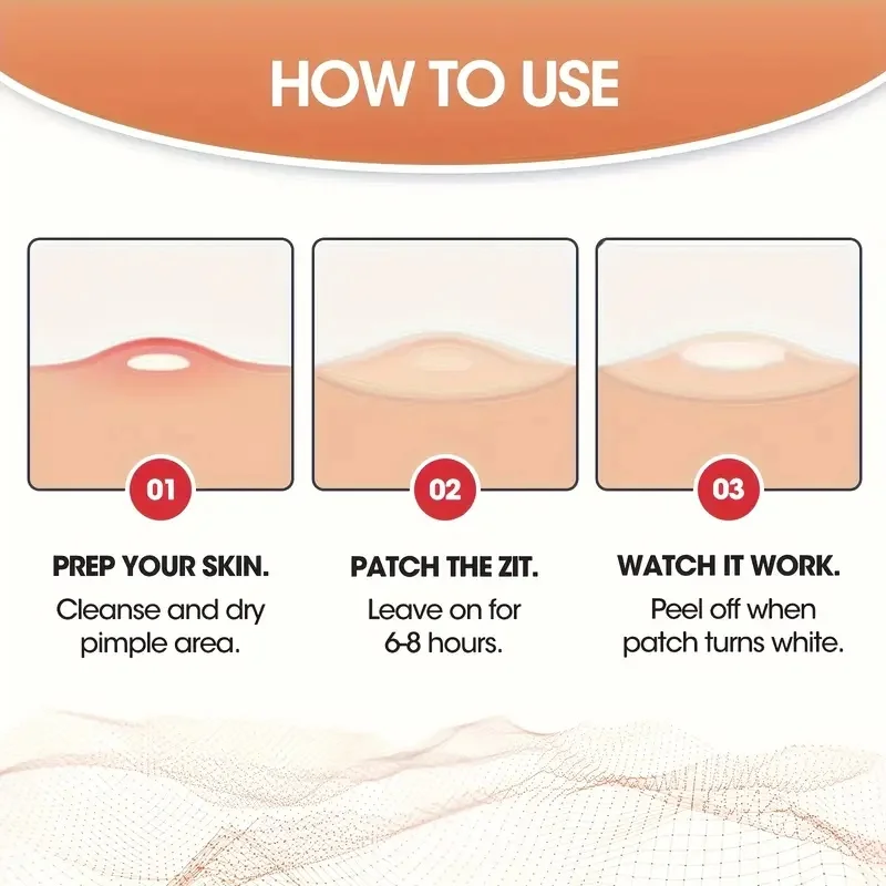 144/288 قطعة من رقع حب الشباب HITWORKER - مقاسين، مناسبة لجميع ألوان البشرة باللون البيج الفاتح للاستخدام الليلي والليلي