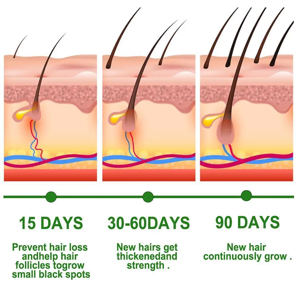 Prodotto essenziale per la cura della bellezza del siero di olio di rosmarino da 30 ml per la crescita e il rafforzamento dei capelli, previene la caduta dei capelli