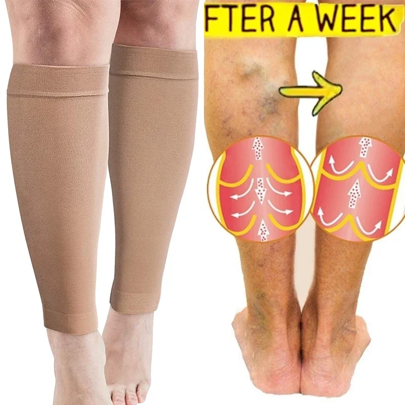 Jambières de compression pour varices, 1 paire, chaussettes longues, bas élastiques, soutien des jambes, tibia, instituts de fatigue