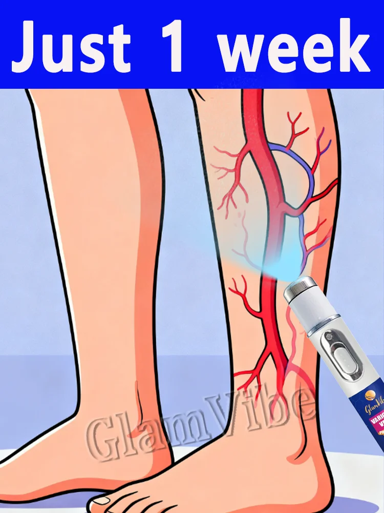 

Варикозное расширение вен на ногах Вени в ногах, руках и по всем телом