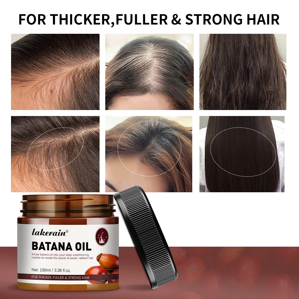 Batana Oil Hair Growth Enhance Efficacy Strengthen Hair Moisturize The Scalp Nutrition To Hair Activate Hair Thicker Strengt