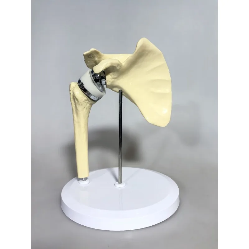 Artificial shoulder joint model Trans artificial shoulder joint