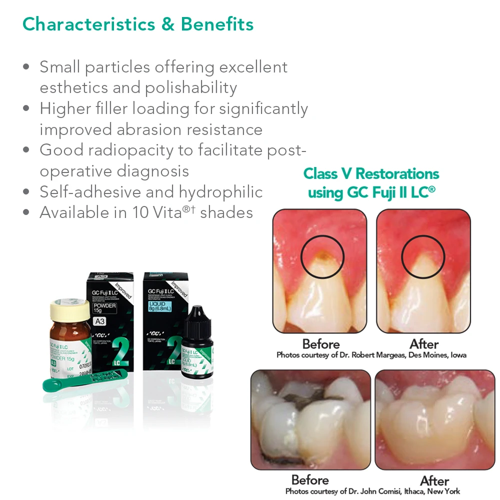 Gc Fuji 2 Lc Luting Dental Light Cure Glassionomer Cement Resin Reinforcement Restoration Filling Material II Gic Dentistry