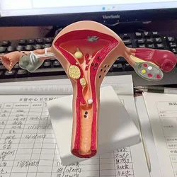 Cross Section Structure Model Human Pathological Uterus Ovary Model Uterus Anatomical Anatomy Female Organ Teaching Study Tool