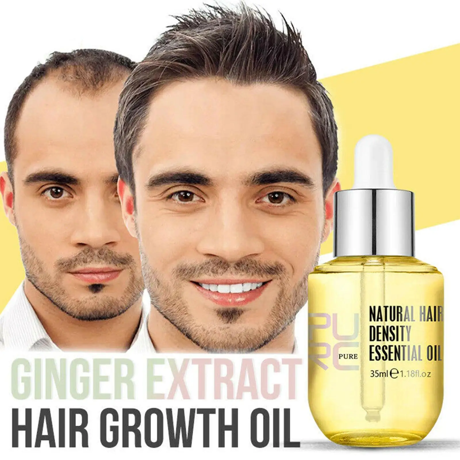 35ml Ginger Natural Hair Density olio essenziale Anti prevenire perdere la ricrescita liquida siero a crescita rapida nutridents Beauty Health Care