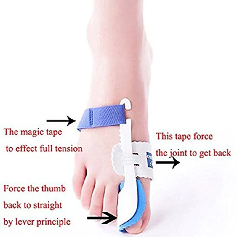 Lisseur d'Hallux Valgus, Ajusteur d'Oignon, Outil de Soins des Pieds, Mathiateur, Paire