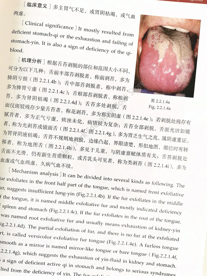 Diagnóstico de lengua de Medicina Tradicional China bilingüe e investigación clínica: una comparación entre chino e inglés