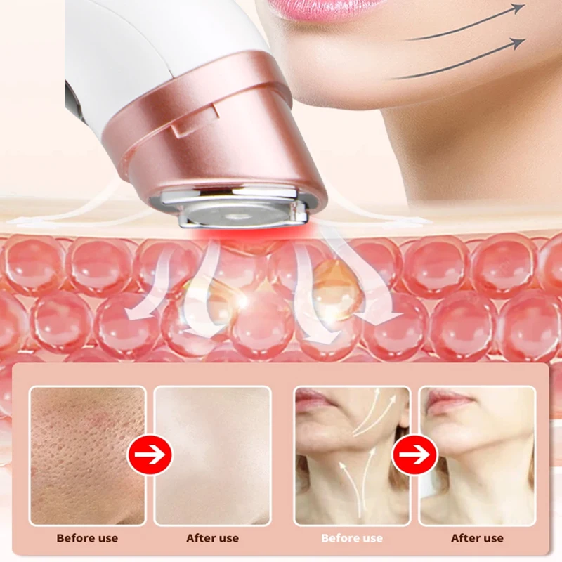جهاز صغير HIFU بالموجات فوق الصوتية EMS جهاز تجميل الوجه مكركرنت لشد العناية بالبشرة أداة مضادة للتجاعيد للوجه