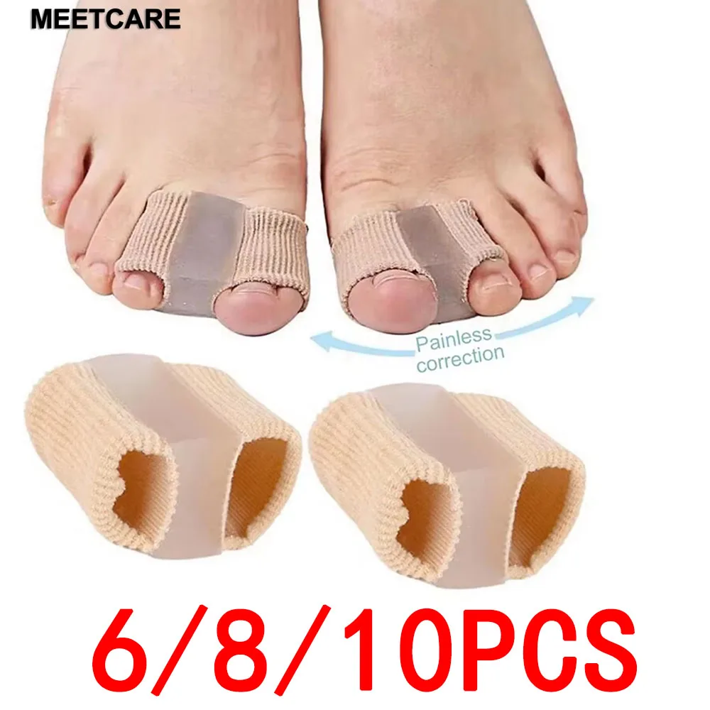 6/8/10 Stück Zehenspreizer Hallux Valgus Bunion Korrektor Orthopädische Einlagen Fußknochen-Versteller Daumen-Richter Pediküre Fußpflege