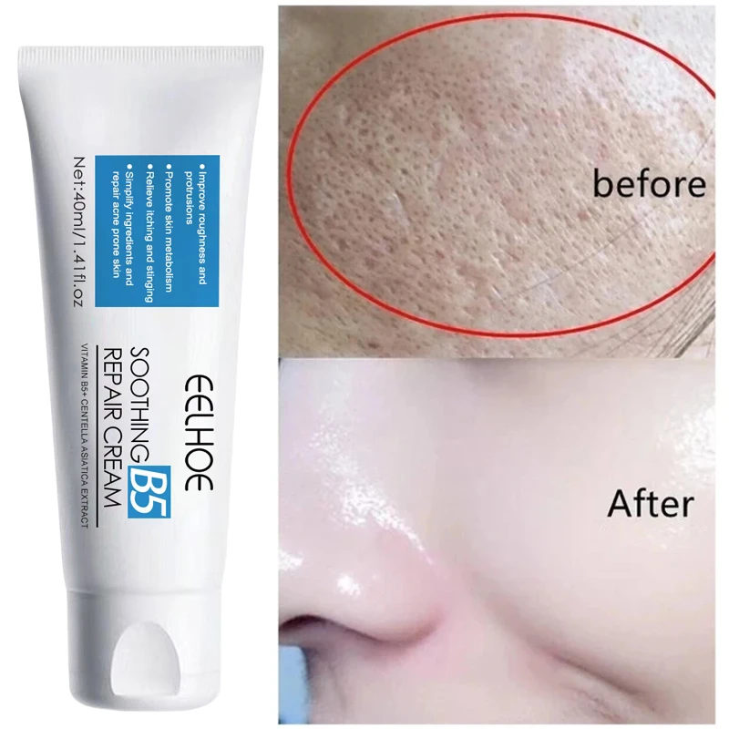 

40ml Repair Cream B5 Moisturizer Repair Cream Soothes Redness Itching Nourishes Improve Repair Sunscreen Cream Wrinkle Removing