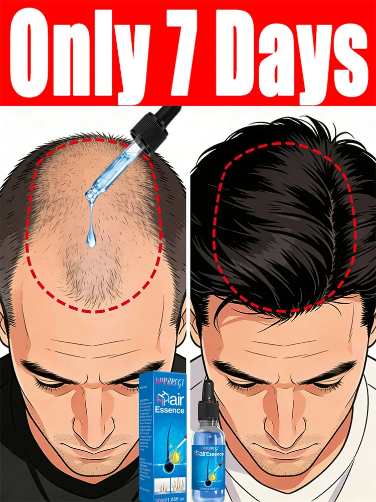 Micron-sized nutrient molecules penetrate the scalp, ᴘʀᴏᴍᴏᴛɪɴɢ ʜᴇᴀʟᴛʜʏ ʜᴀɪʀ ɢʀᴏᴡᴛʜ.