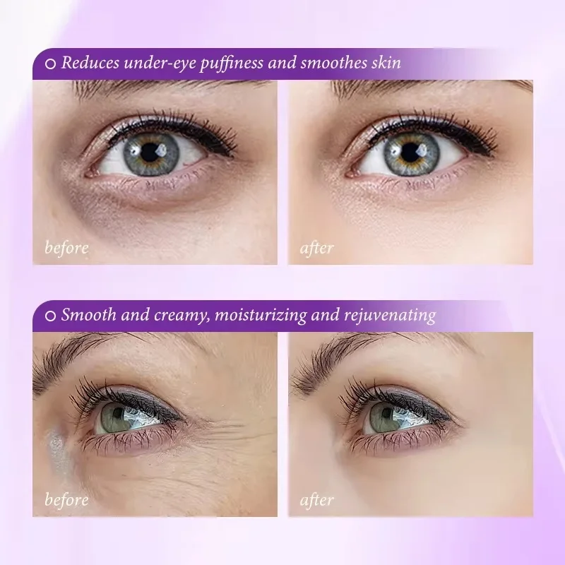 Instant Eye Bag Removal Cream Collagen Anti-Wrinkle Fade Fine Lines Firming Skin Anti Dark Circle Puffiness Brighten Eye Care