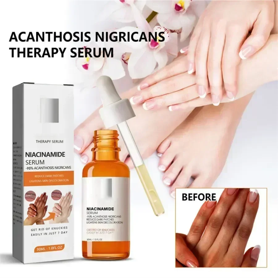 

Dark knuckles whitening serum Elbows Armpit Beaching SerumWoman Private Part Skin Removal Dark Knuckles Strong Whitening Serum