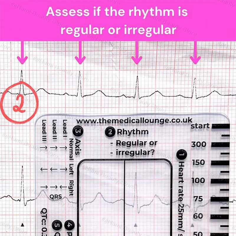 بطاقة تفسير ECG ذات 7 خطوات، دليل مرجعي لـ ECG EKD للجيب المحمول، معدات للتمرين في صالة الألعاب الرياضية، مراقبة الصحة