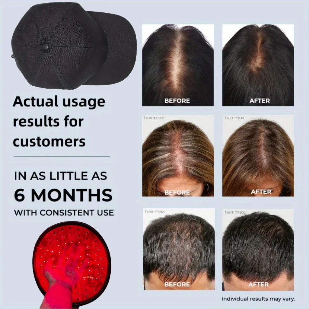 Medical Grade HLKGO Laser Hair Regrowth Helmet CE Certified LLLT Therapy Cap for Thinning Hair and Baldness