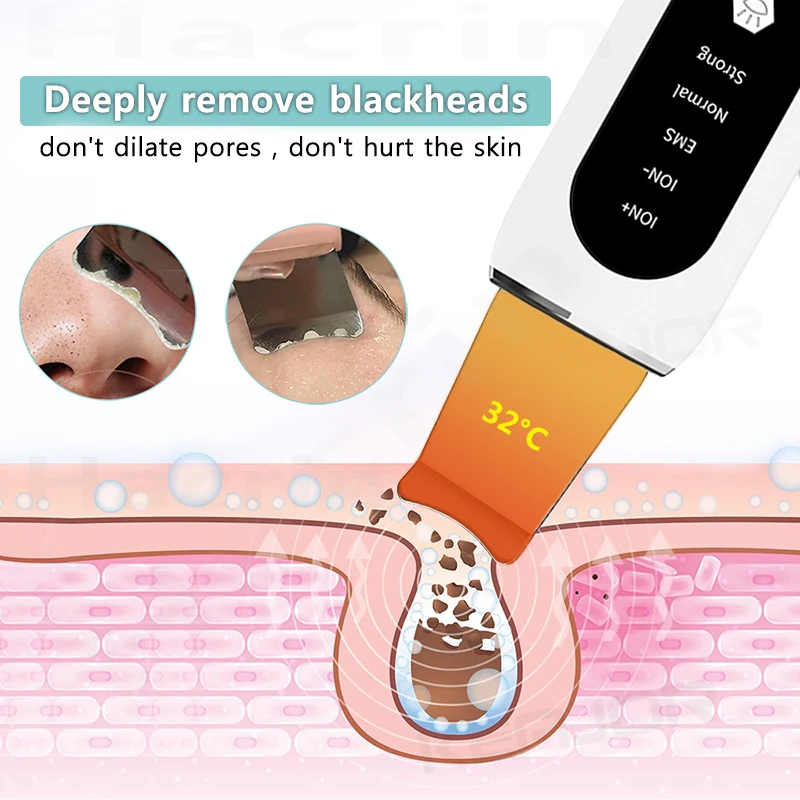 Ultrasonic Skin Scrubber Blackhead Remover Deep Face Cleaning Ultrasonic Cleaner Shovel Facial Peeling Cleaning Acne 26000hz