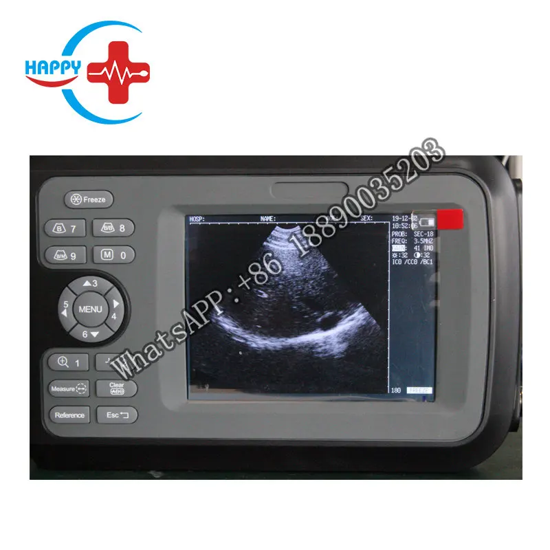 

HC-A032V Veterinary handheld Ultrasound Scanner for pregnancy/Portable Animal