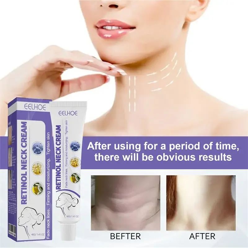 

EELHOE Retinol Neck Cream Neck Massage Fades Neck Lines Nourishes Firms And Moisturises Neck Brightens And Reshapes Swan Neck