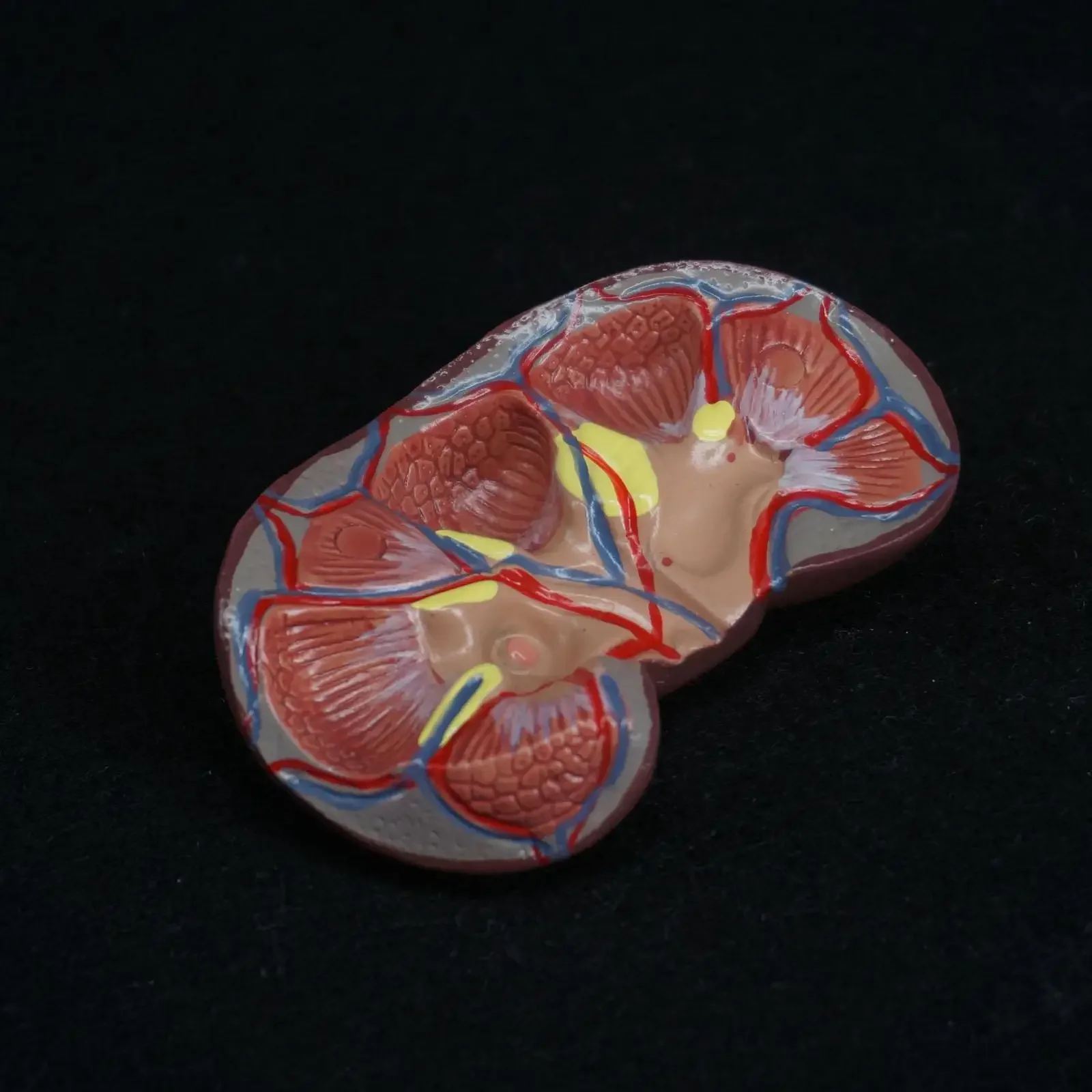 Human Kidney with Adrenal Gland Anatomical Medical Model Urology Anatomy Natural Life Size Teaching Resources