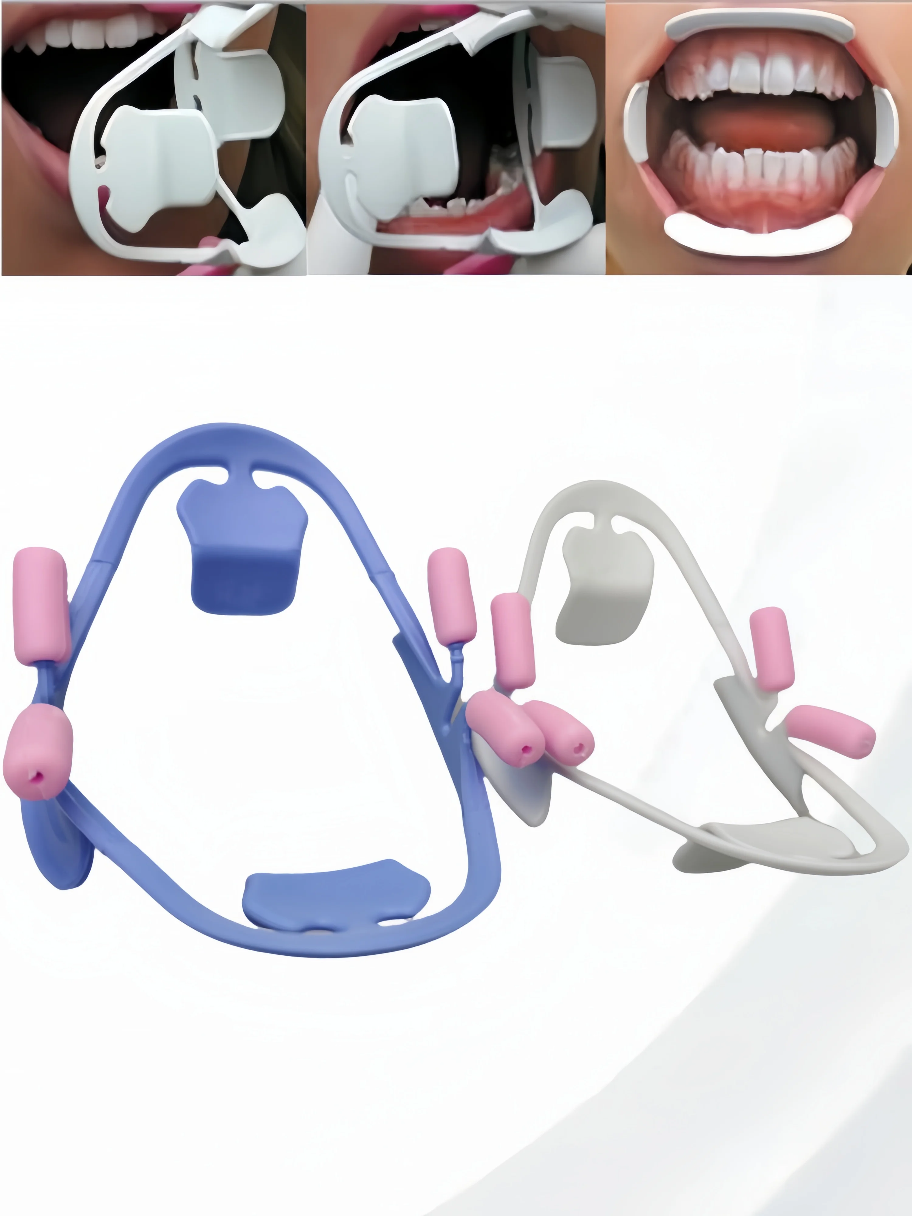 ضام الخد ثلاثي الأبعاد للأسنان - فتاحة فم لتبييض الأسنان على شكل حرف O، ضام شفاه لتقويم الأسنان لجراحة الفم وتبييض الأسنان #2