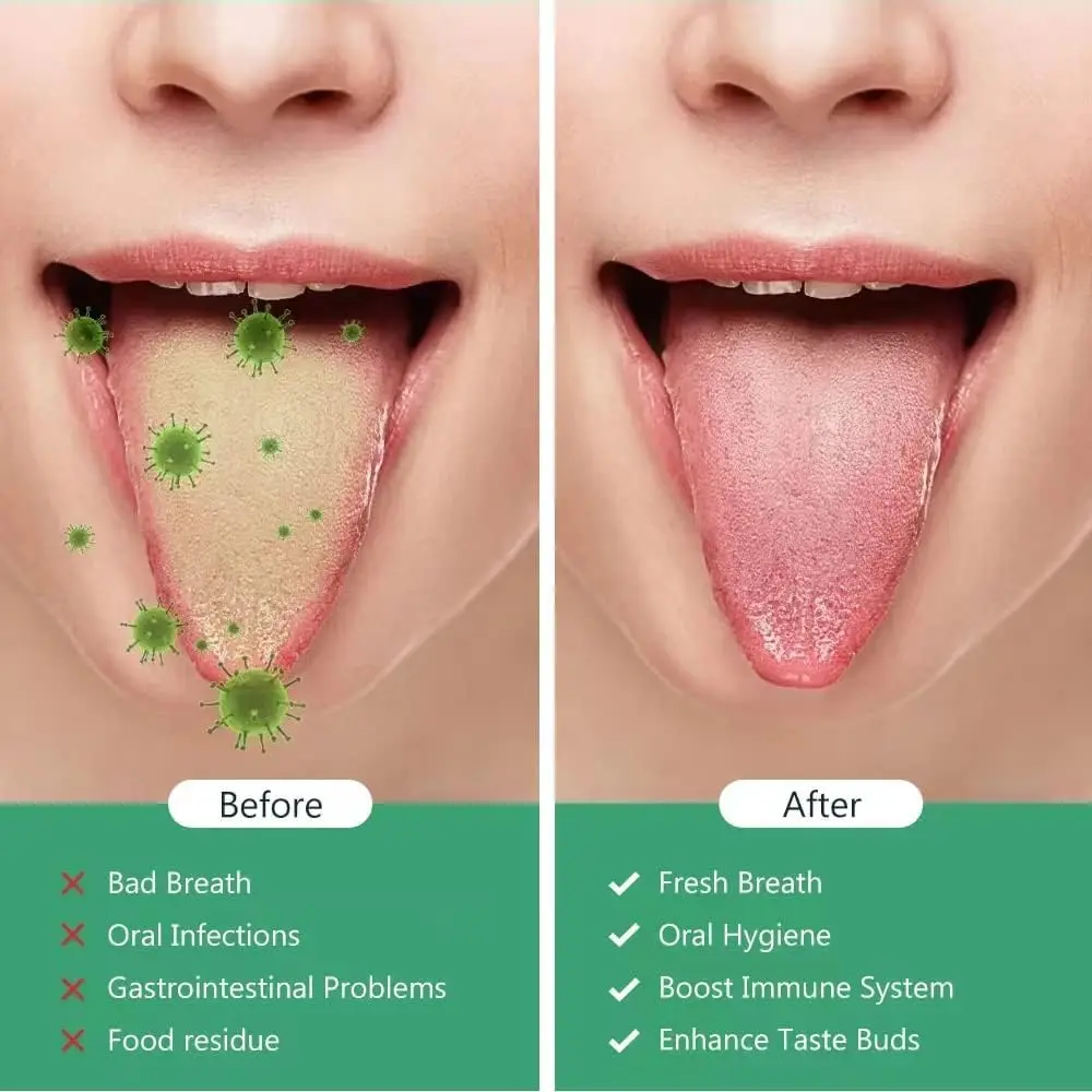 Tongue Scraper, Stainless Steel Tongue Cleaner for Adults Kids, Dental Oral Care Tools, Coating Cleaning Reduce Bad Breath