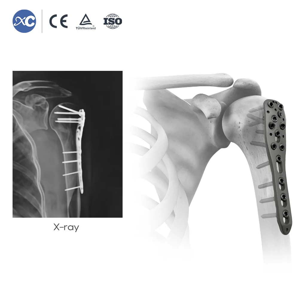 XC MEDICO 2.7 3.5mm Small Fragment Medical Orthopedic Trauma Surgical Tools Small Surgery Instrument Set For Bone Plate Fixation
