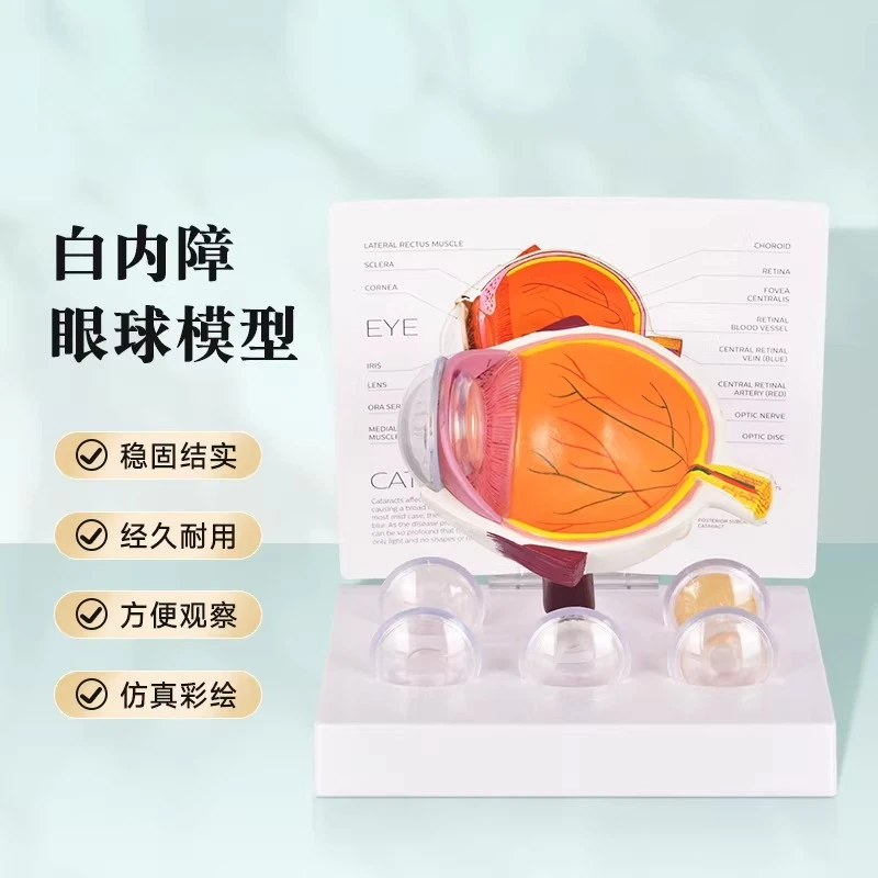 

Medical Human Eye Model Cataract Pathology Eye Anatomy Model Eye Structure Biology Teaching Mould