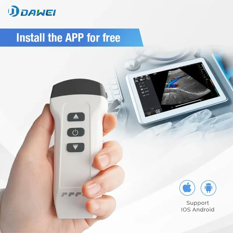 Pocket handheld color doppler ultrasound Wireless USG 2 IN 1