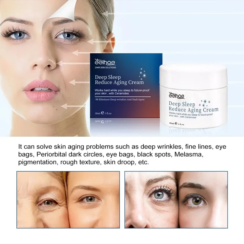 Anti-Rimpelcrème Face Lift Versteviging Verminderen Fijne Lijntjes Verhelderen Gezichtsverzorging Hydraterende Anti-Aging Voedende Slaapcrème